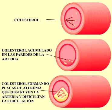 Colesterol Colesterol