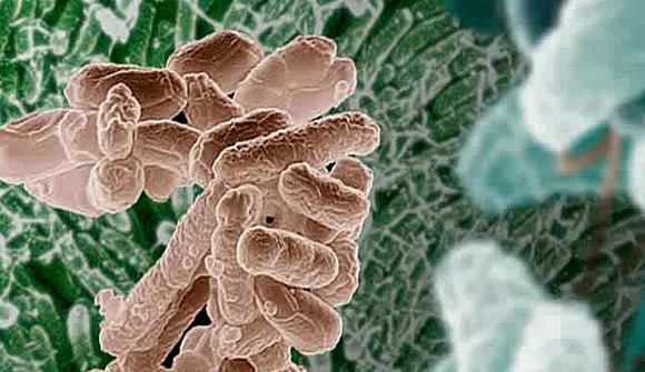 Bacterias