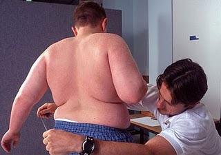 Obesidad