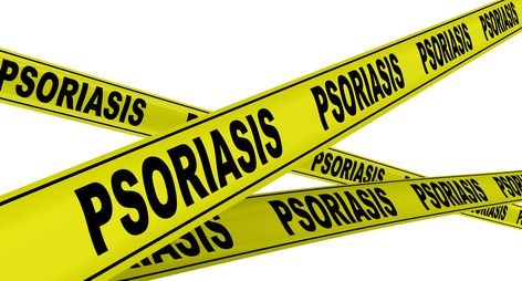 Псориаз (psoriasis). Желтая оградительная лента